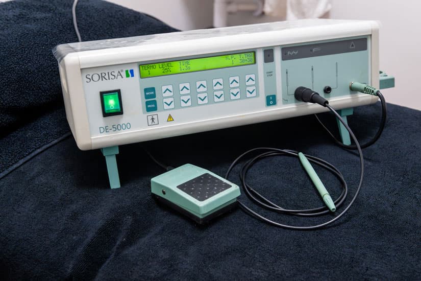 Servicios de depilación eléctrica en Vigo